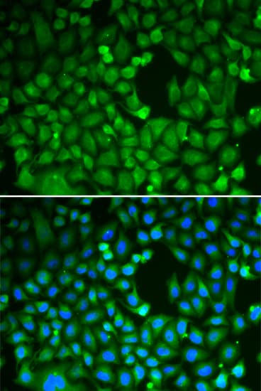 CDC5 / CDC5L Antibody
