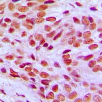 Polyclonal Rabbit anti-Human FLI1 Antibody (Internal, IHC, WB)