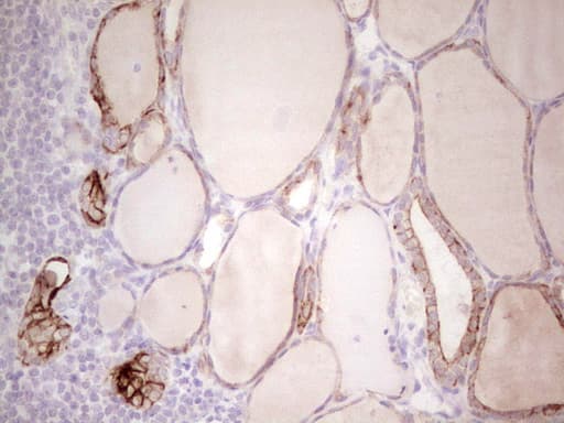 ABCB1 / MDR1 / P Glycoprotein Antibody (aa995-1280, clone OTI10H3, Carrier-free)