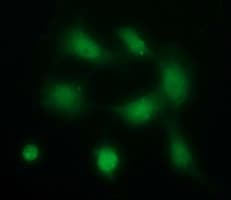 PDGFRB / PDGFR Beta Antibody (clone OTI3B5)