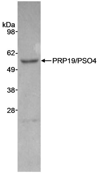 PRPF19 / PRP19 Antibody (aa450-C-term)