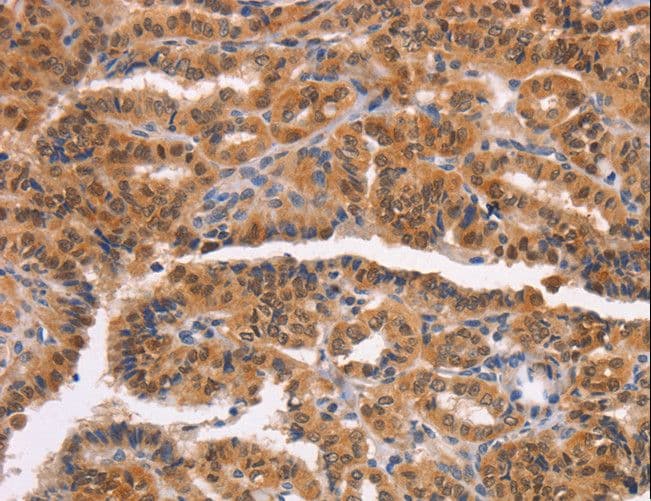 Polyclonal Rabbit anti-Human CAP-G2 / MTB Antibody (IHC)