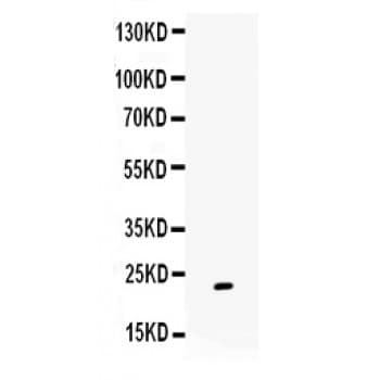 GREM1 / Gremlin-1 Antibody (aa151-184)