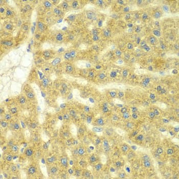 ADCK3 / CABC1 Antibody