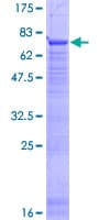 Human HACD2 / PTPLB Protein (Recombinant GST)