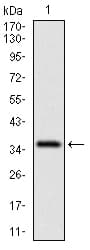 Monoclonal Mouse anti-Human CD7 Antibody (clone 4D4F8, aa72-175, IHC, WB)