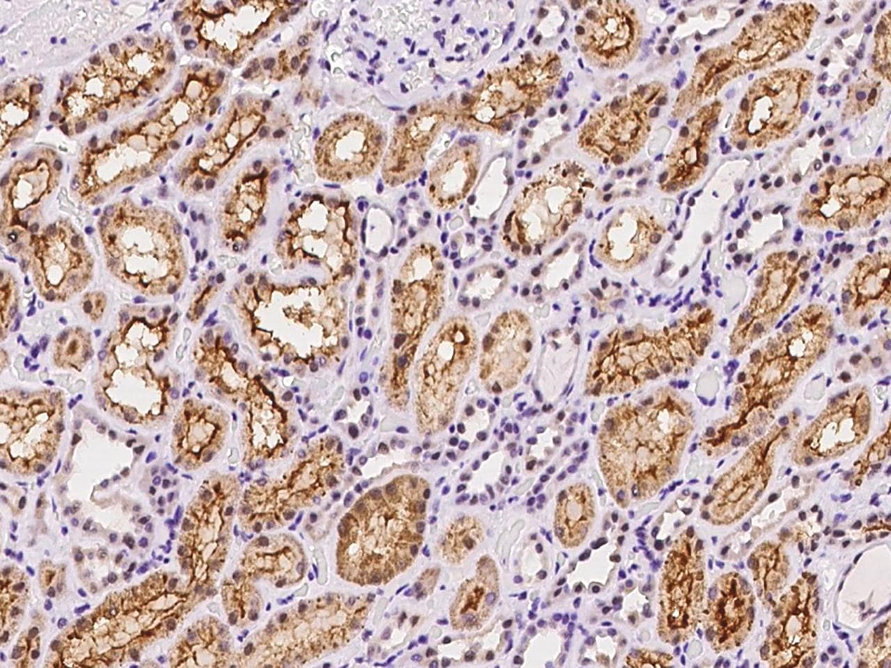 NUFIP1 / NUFIP Antibody