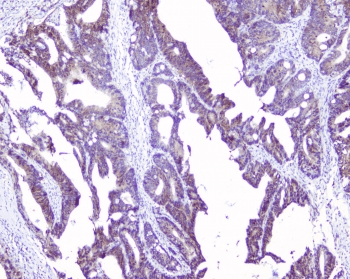 Polyclonal Rabbit anti-Human SRI / Sorcin Antibody (IHC, WB)