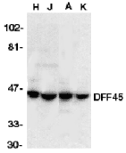 DFFA / ICAD / DFF45 Antibody