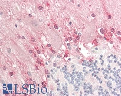 IHC-plus™ DFNA5 Antibody