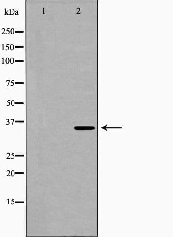 P2RY6 / P2Y6 Antibody