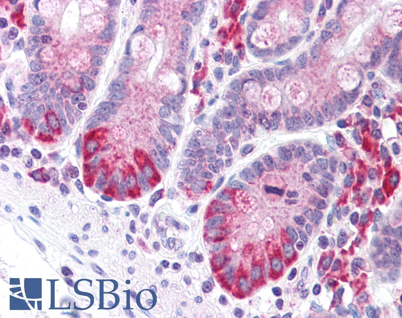 IHC-plus™ LRRN4 / C20orf75 Antibody (C-Terminus)