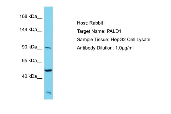 Polyclonal Rabbit anti-Human PALD1 / Paladin 1 Antibody (aa143-192, WB)