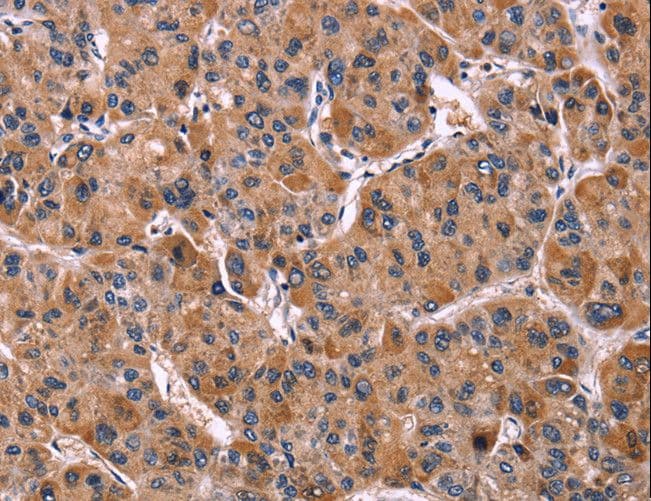 ILT2 / CD85 Antibody