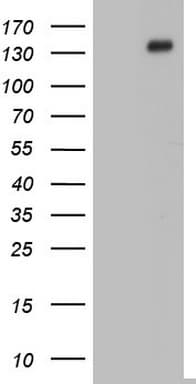 GLI / GLI1 Antibody (aa1-410, clone OTI1B4)