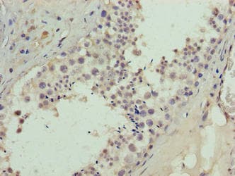 Polyclonal Rabbit anti-Human BATF2 / SARI Antibody (IHC)