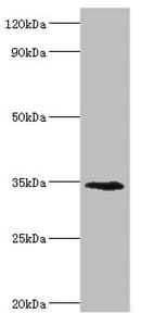 Polyclonal Rabbit anti-Human LYVE1 Antibody (aa20-238, IHC, WB)