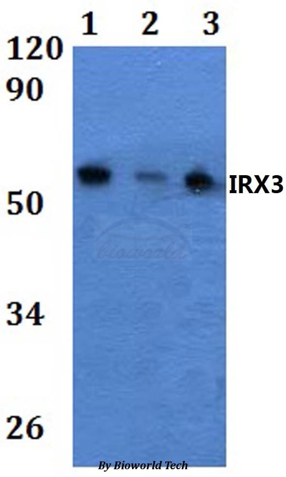 Polyclonal Rabbit anti-Human IRX3 Antibody (WB)