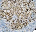 BCL6 Antibody (clone RBT-bcl6)