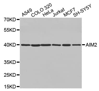 Polyclonal Rabbit anti-Human AIM2 Antibody (WB)