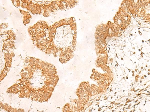 Polyclonal Rabbit anti-Human POLR1D Antibody (IHC)