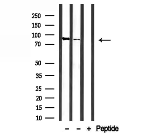 Polyclonal Rabbit anti-Human PNISR Antibody (WB)