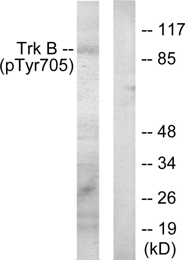 NTRK2 / TRKB Antibody (phospho-Tyr705)