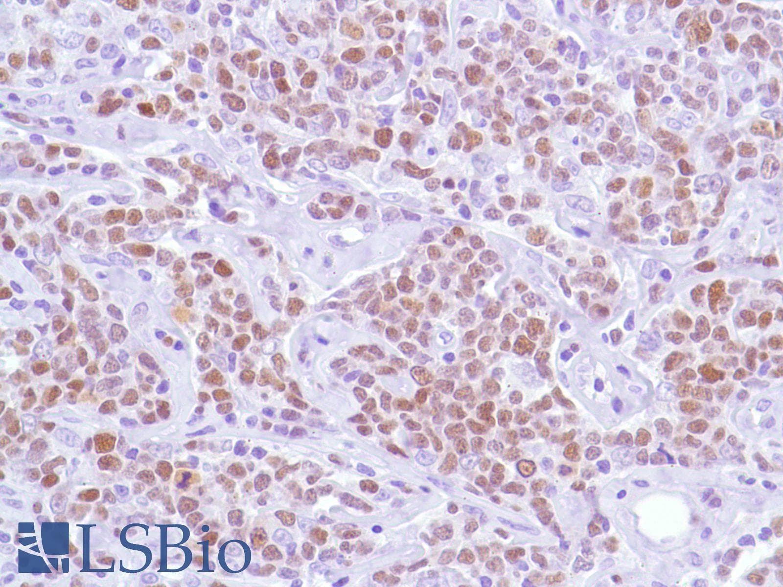 Monoclonal Rabbit anti-Human BCL6 Antibody (clone SP155, C-Terminus, IHC)