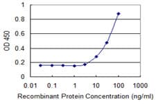COL9A1 / Collagen IX Antibody (clone 3H1)