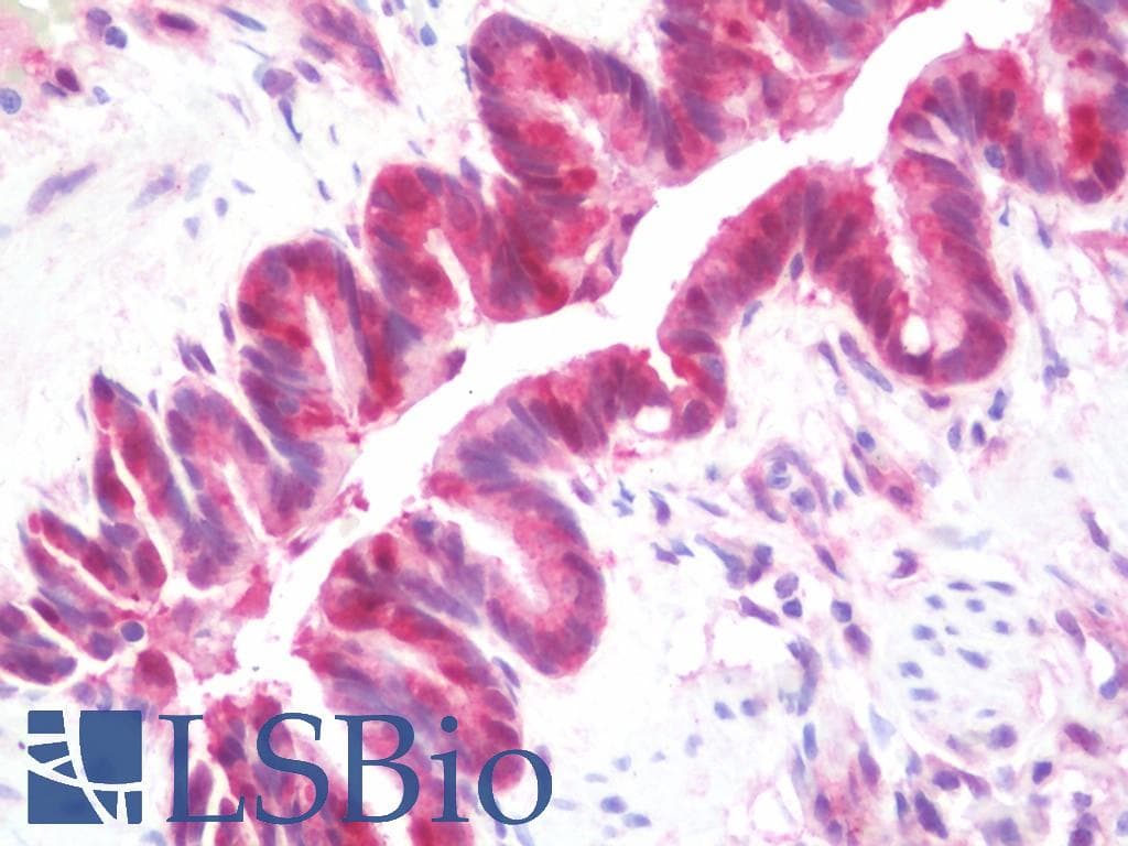 IHC-plus™ GSTT1 Antibody (aa1-240)