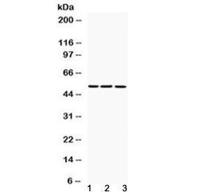 FGG / Fibrinogen Gamma Antibody