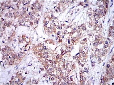 UBE2I / UBC9 Antibody (clone 1B10)