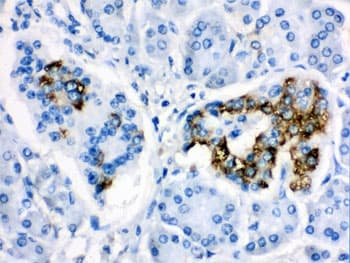 Polyclonal Rabbit anti-Human CYP24 / CYP24A1 Antibody (aa153-514, IHC, WB)