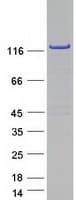 Human VARS / ValRS Protein (Recombinant Myc-DDK (Flag))