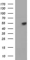 IHC-plus™ TUBB1 / Tubulin Beta 1 Antibody (clone 4A3)