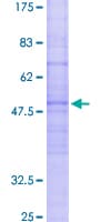 Human ACKR2 / CCR10 / D6 Protein (Recombinant GST)