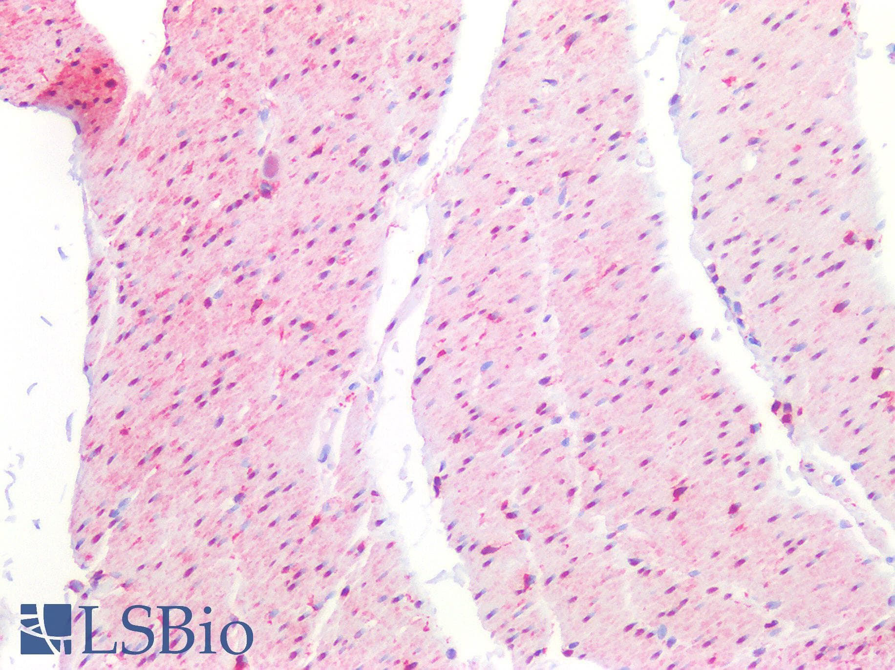 IHC-plus™ NET1 / ARHGEF8 Antibody