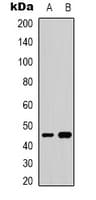 GATA5 Antibody (Internal)