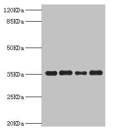 PDXK / PNK Antibody
