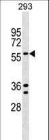 Polyclonal Rabbit anti-Human TRAFD1 / FLN29 Antibody (aa542-569, WB)