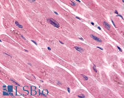 PathPlus™ Polyclonal Rabbit anti-Human FZD7 / Frizzled 7 Antibody (N-Terminus, IHC)