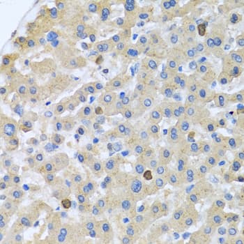 Apolipoprotein A-V Antibody