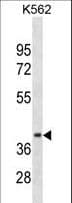 CCNDBP1 / GCIP Antibody (aa21-49)