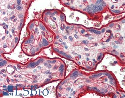 IHC-plus™ Integrin Alpha5 Beta1 Antibody
