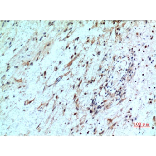 CXCR2 Antibody (1-50 aa, N-terminal)