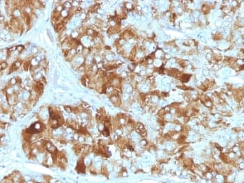 CHGA / Chromogranin A Antibody (clone CGA/413)