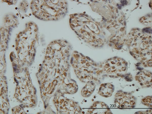 NCAPD2 Antibody (clone 4C12)