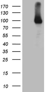 Monoclonal Mouse anti-Human R1 / RRM1 Antibody (clone OTI6G8, aa541-792, IHC, WB)