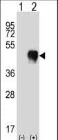 CD32A Antibody (aa256-285)