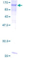 Human Complement C6 Protein (Recombinant GST)